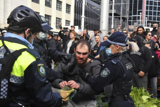 欧洲又炸锅了！法国、英国、意大利等国爆发大规模示威游行！美国日增新冠病例或再达20万！ 